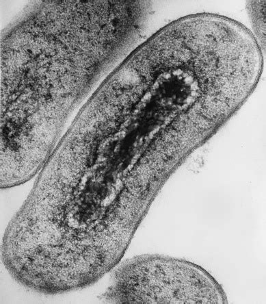 Microscopia Electrónica De Las Bacterias Foto de stock y más banco de ...