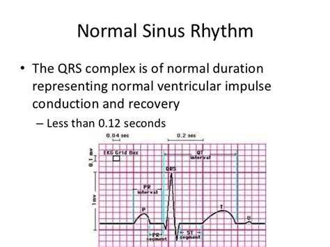 normal qrs duration – ekg results normal ranges – Schleun