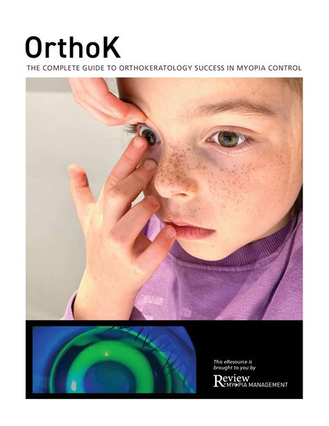 Orthokeratology Contact Lenses Archives - Review of Myopia Management