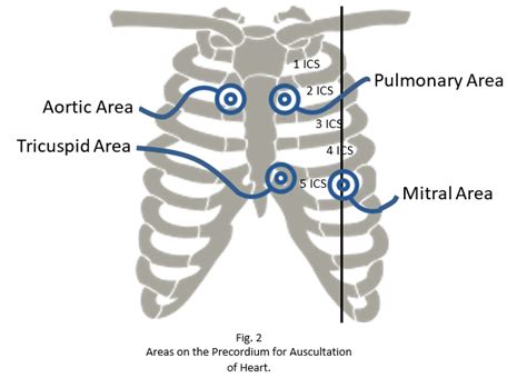 Heart Sounds - Clinically Explained | Epomedicine