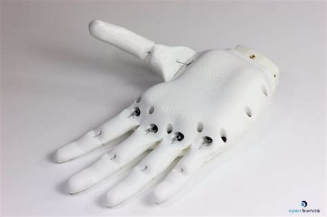 Why Marginally Clever Robots doesn’t make Prosthetic Arms, Hands, Legs ...