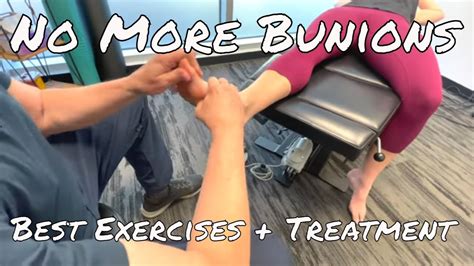 Best Bunion Exercises and Nonsurgical Treatment - YouTube