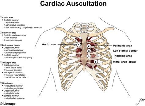 Heart Murmur Sounds | Faculty of Medicine