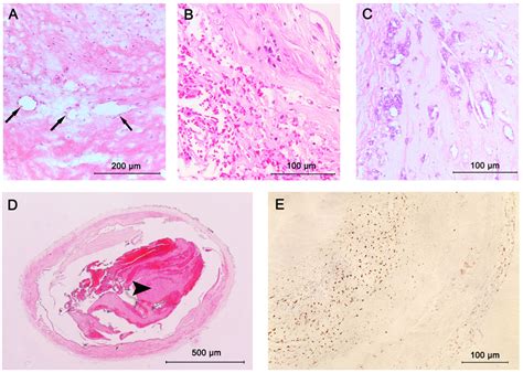 Frontiers | Histological Characteristics of Intracranial ...