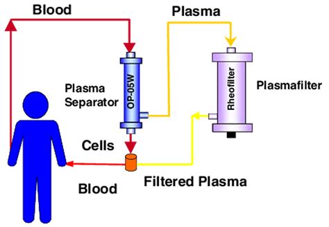 Plasmapheresis - Indications, Plasmapheresis Side Effects