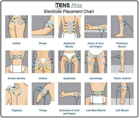 TENS unit electrode placement chart for different sports/life injuries ...