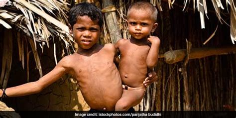 Concerted Efforts Can Make India Free From Malnutrition: Experts