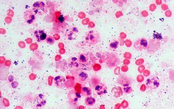 Streptococcus intermedius