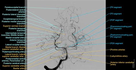 Cerebral Angiography Anatomy