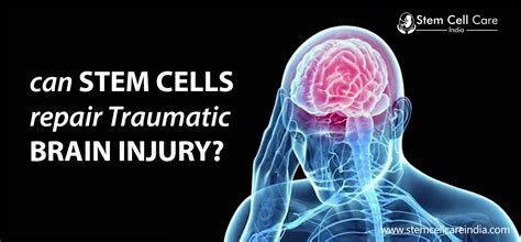 Can Stem Cells Repair Traumatic Brain Injury Home