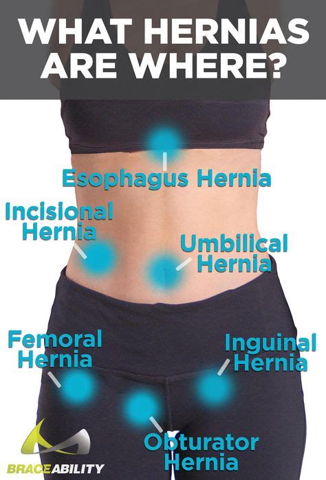 Pin by Mario Domingue on Medical in 2020 (With images) | Abdominal ...