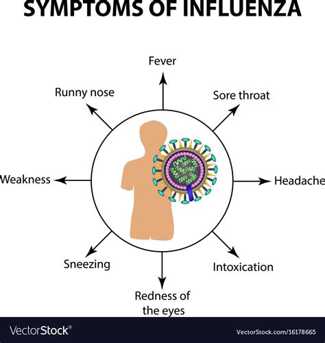 Symptoms infections of the influenza virus Vector Image