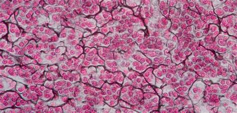 Recticular tissue-Chelsey | Fiber, Tissue, Adipose tissue