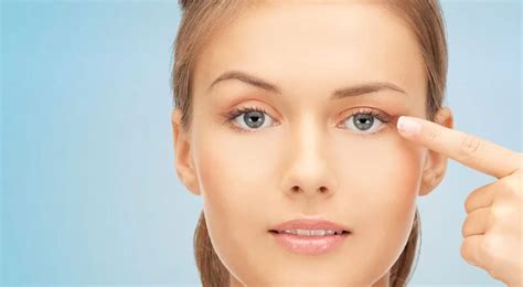 Ptosis after Botox? Discover How to Treat Drooping Eyebrows and Eyelids ...