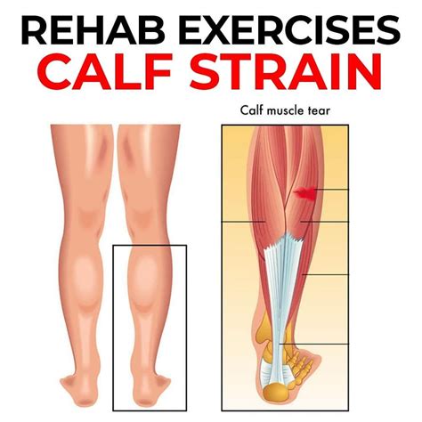 🚨 3 CALF STRAIN REHAB EXERCISES 🚨 The calf muscle consist of the ...