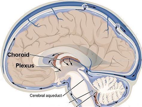 CPC|Choroid Plexus Cysts