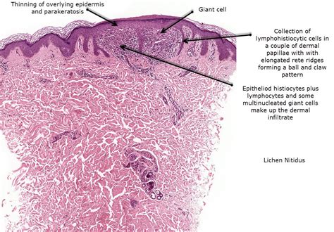 Pin on Dermatopathology