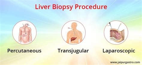 Liver Biopsy Procedure Center in Jaipur | Dr. Shankar Dhaka