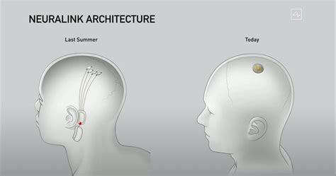 Elon Musk's Neuralink unveils sleek V0.9 device, uses sassy pigs for ...