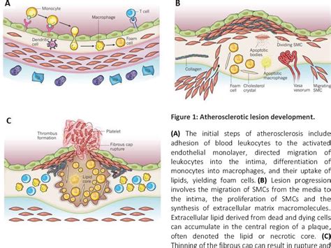 Figure 1 from Macrophage regulatory mechanisms in atherosclerosis ...