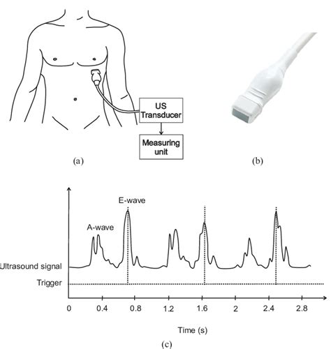 Illustration of Doppler ultrasound system principles and deployment ...