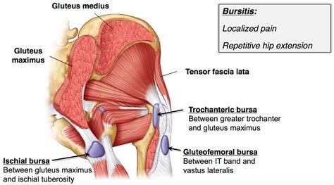 Ischial bursitis definition, causes, symptoms, diagnosis & treatment