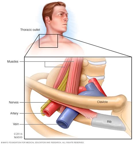 Thoracic Outlet Syndrome Anatomy