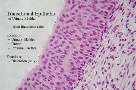 transitional epithelium