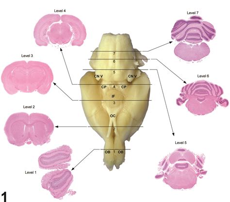 Image of Seven transverse (coronal sections) in the Brain from a Rat ...