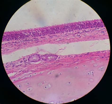 Pseudostratified Columnar Epithelium - Definition & Function