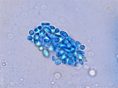 Fun With Microbiology (What's Buggin' You?): Trichosporon species