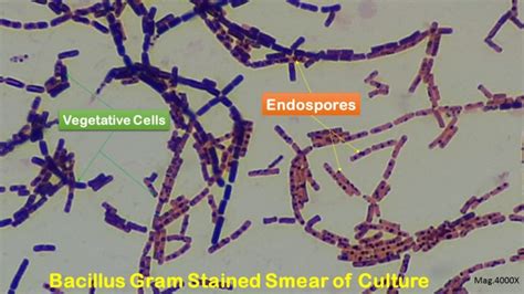 Spore Stain: Introduction, Principle, Requirements, Procedure, Result Int