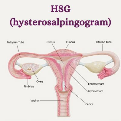 What is HSG | Procedure of HSG test | Chandigarh-dr. Shikha