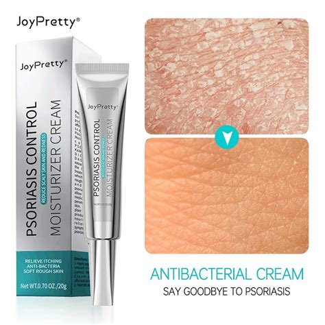 Joypretty Herbal Against Psoriasis Skin Cream Ointment Antibacterial ...