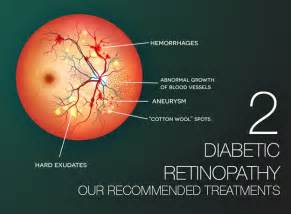 Diabetic Retinopathy Part 2: Our Recommended Treatments | Fairfax VA ...