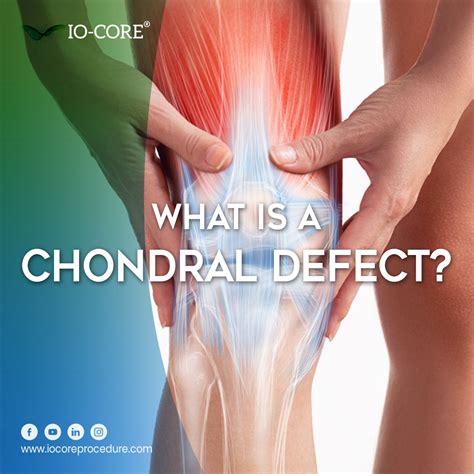 What Is a Chondral Defect? | iO-Core