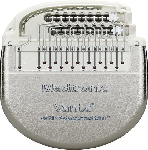 FDA approves Medtronic neurostimulators to treat chronic pain from DPN