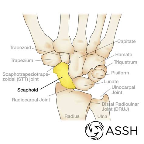 Carpal Bones | MedicineBTG.com