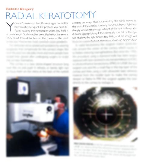 SOLUTION: Robotic surgery radial keratotomy - Studypool