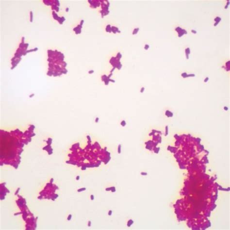 E Coli Under Microscope Gram Stain - Micropedia