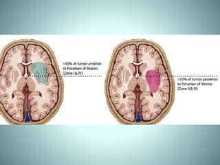 Insular lobe anatomy | PPT