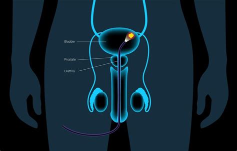 Premium Vector | Cystoscopy is a minimally invasive procedure ...