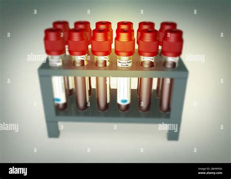 Blood viles hi-res stock photography and images - Alamy