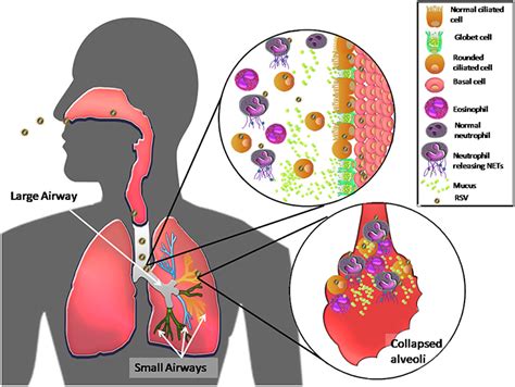 Frontiers | Host Components Contributing to Respiratory Syncytial Virus ...