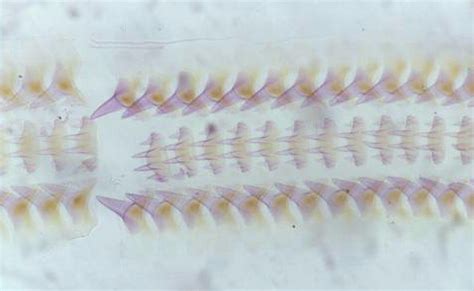 Mollusc Radulae from microscope slides at the Booth Museum, Brighton