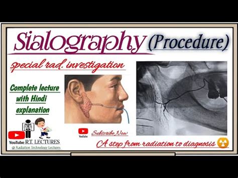 #Sialography Procedure Complete Lecture// #Sialography radiology ...