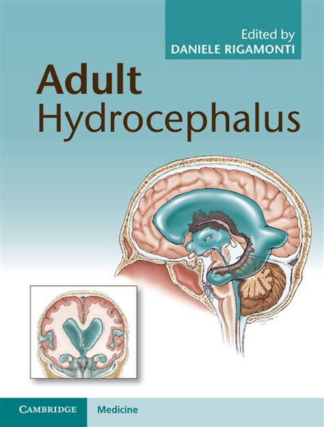 Hydrocephalus shunt procedures (Chapter 16) - Adult Hydrocephalus