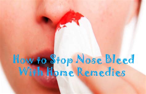 20 Easy Home Remedies to Stop Nose Bleeding in Children and Adults fast