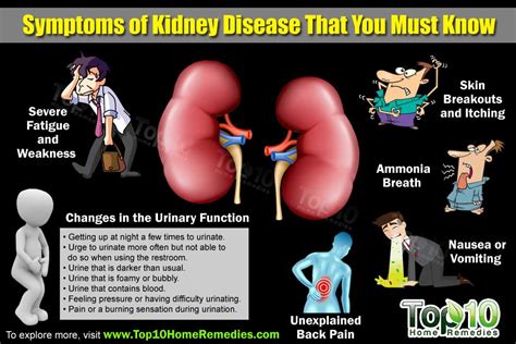 10 Symptoms That Should Alert You About Kidney Disease | Top 10 Home ...