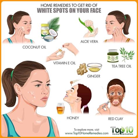 Get rid of white spots on face #ExfoliatingFaceScrub in 2020 | Skin ...